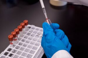 Une prise de sang pour dépister Alzheimer 20 ans plus tôt